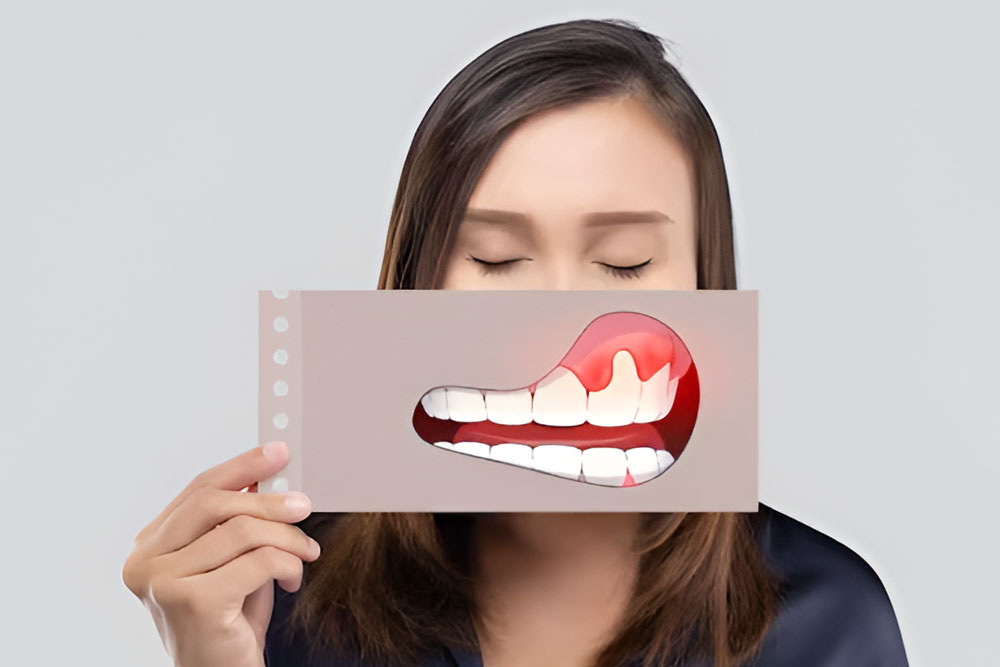 Periodoncia - sumar salud - clínica dental Eduardo Martos